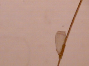 Image of  head louse nit egg attached to a hair shaft.