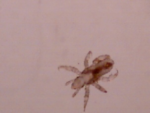 Image of a head louse nymph .